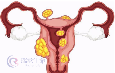 高龄怀孕易发生胎停的原因？如何避免？