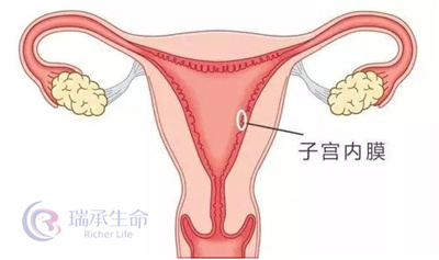 子宫内膜只有3毫米，可以做试管婴儿吗？