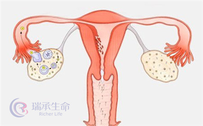 如何在做试管婴儿时有效规避促排期间出现的问题？