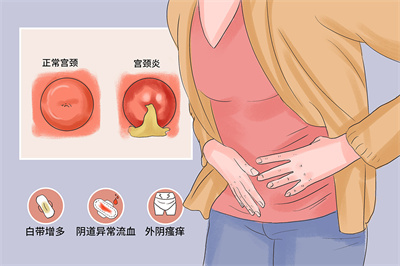 慢性宫颈炎对胚胎着床有影响吗?有何应对措施？
