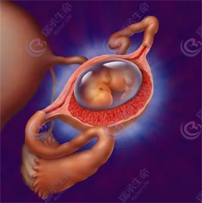 做试管婴儿后，是否还会发生胎停或宫外孕的情况呢？