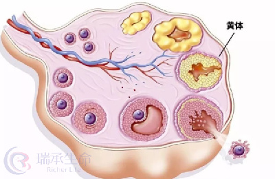 黄体功能不足怎么办？做试管婴儿能成功吗？
