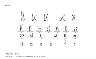 习惯性流产，找到病因才是关键！